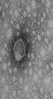 The Association Between Borna Disease Virus and Mood Disorders: A Systematic Review and Meta-Analysis